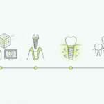 как проходит имплантация зубов этапы и сроки
