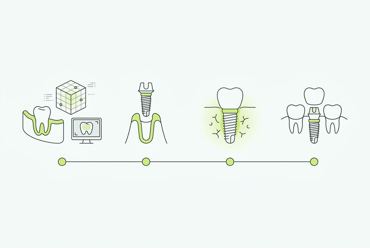 как проходит имплантация зубов этапы и сроки